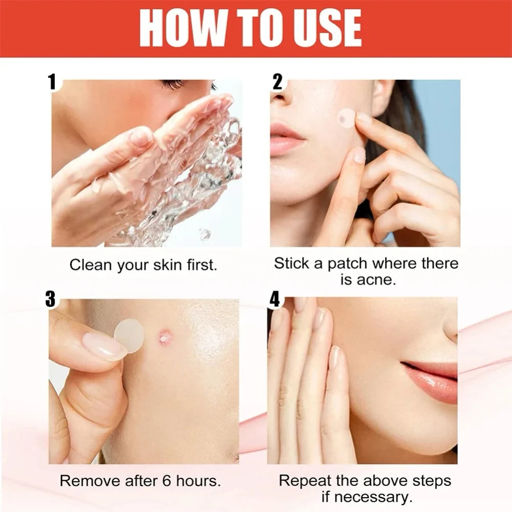 144pcs Invisible Hydrocolloid Acne Patch