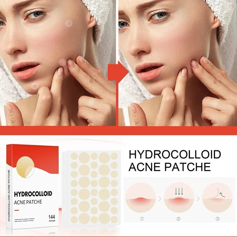 144pcs Invisible Hydrocolloid Acne Patch