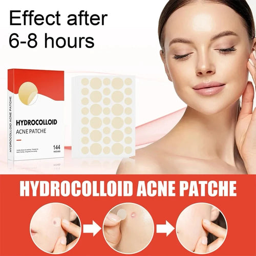 144pcs Invisible Hydrocolloid Acne Patch